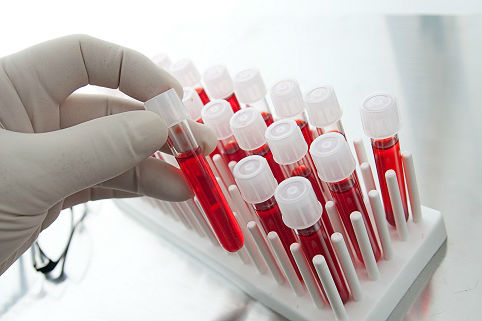Антитела в крови после коронавируса сохраняются более 6 месяцев &#8212; исследование