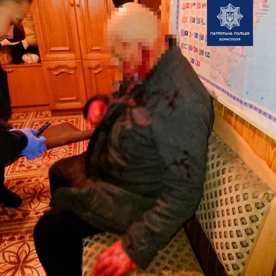 В Борисполе голый мужчина «под кайфом» изрезал ножом отца