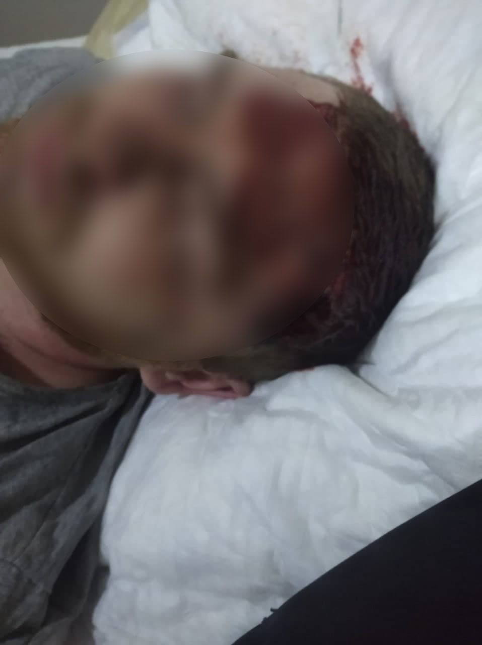 Экс-полицейский выстрелил парню в голову &#8212; СМИ