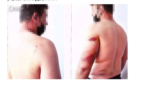 Бывшего опера обвинили в избиениях подозреваемых