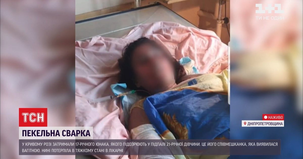 В Кривом Роге парень поджег свою девушку: врачи борются за ее жизнь