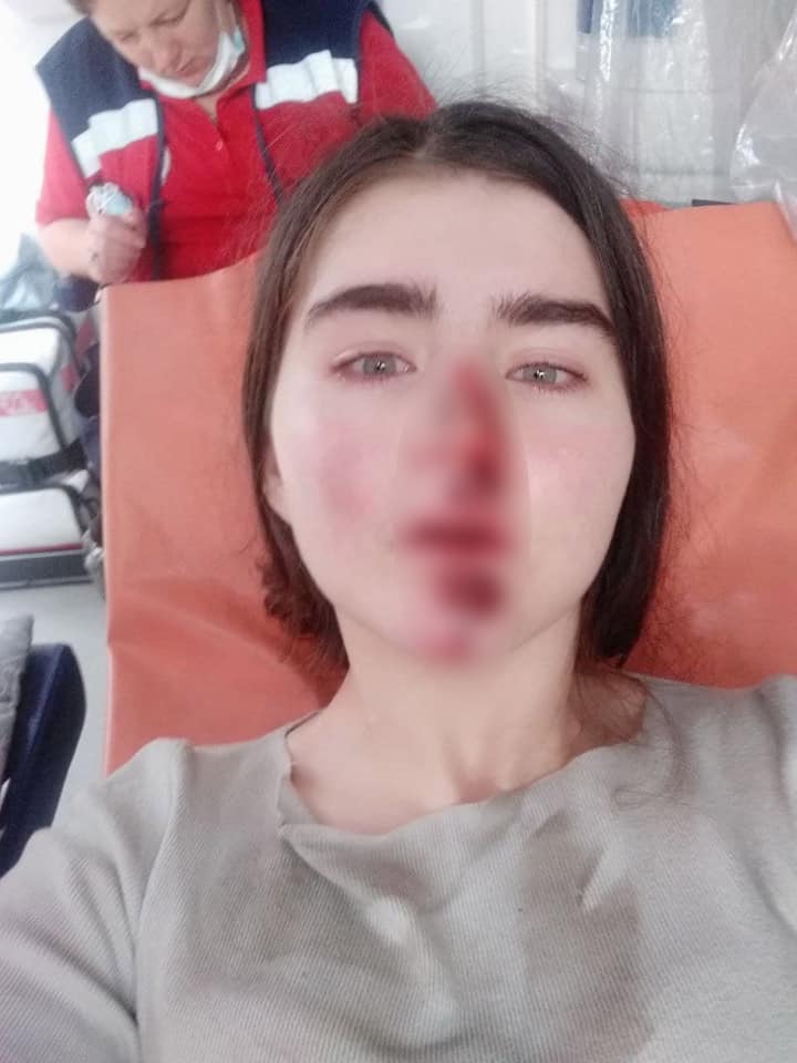 Отказали тормоза: в Киеве девушка-самокатчица серьезно пострадала (ФОТО)