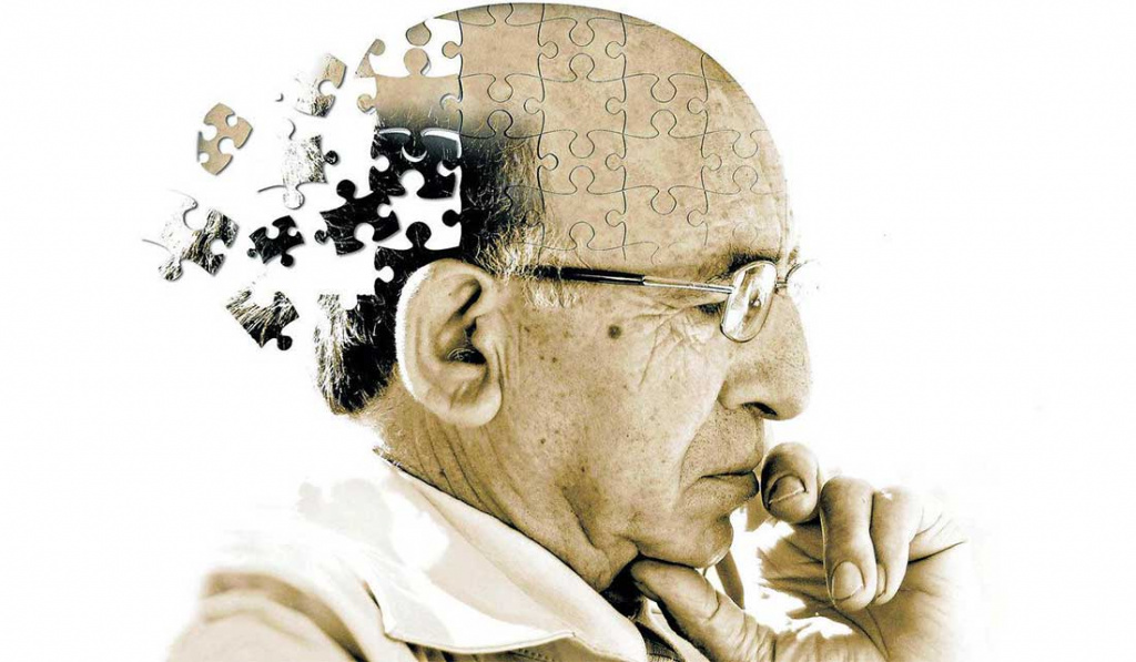 В США одобрили препарат для лечения Альцгеймера