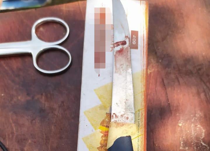 Под Харьковом женщина зарезала супруга кухонным ножом (ФОТО)