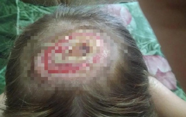 Под Ровно после визита к парикмахеру девушка попала в больницу (ФОТО)