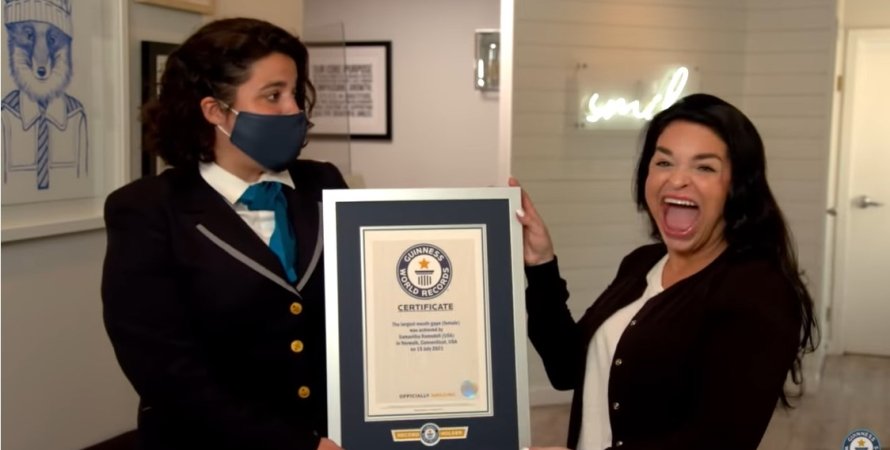 31-летняя женщина с самым большим ртом в мире попала в Книгу рекордом Гиннеса (ФОТО, ВИДЕО)
