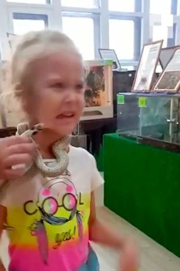 В России змея укусила 5-летнюю девочку за лицо (ФОТО)