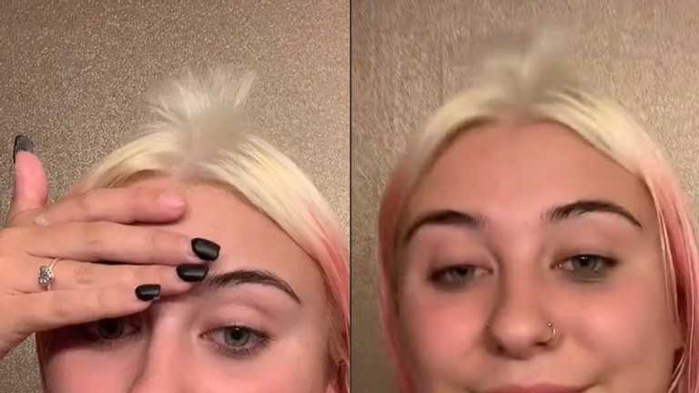 Девушка сильно облысела, попытавшись покрасить волосы (ВИДЕО)