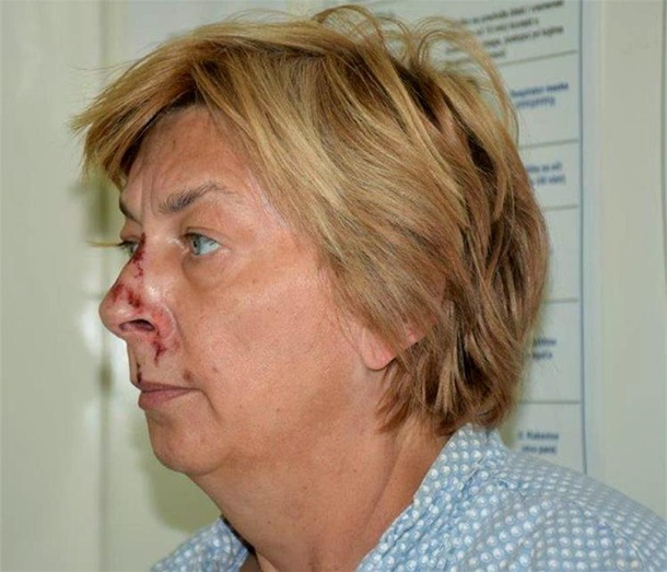 Ничего не помнит: в Хорватии нашли женщину с разбитым лицом (ФОТО)