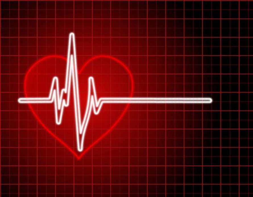 Медики рассказали, кто подвержен риску внезапной остановки сердца