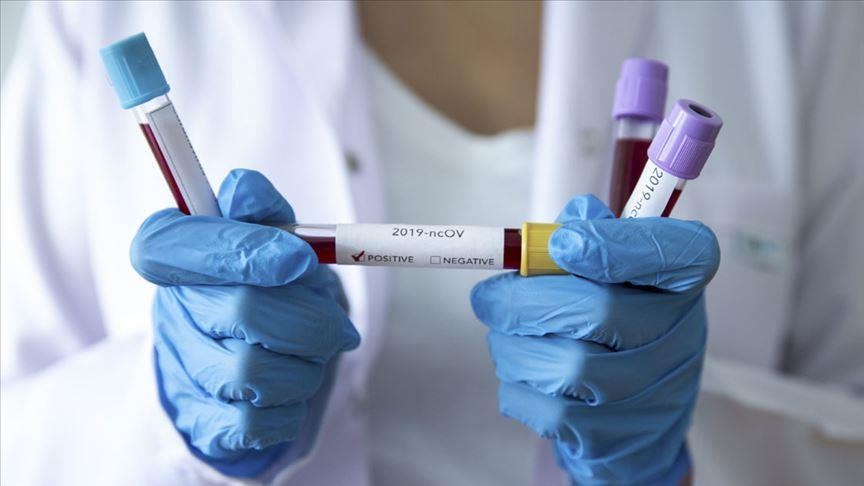 В Украине почти 12 тысяч новых случаев коронавируса