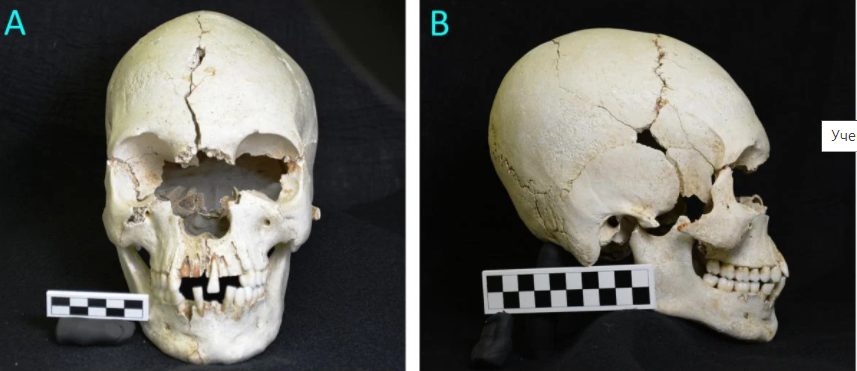 В США исследовали 200-летний загадочный череп (ФОТО)