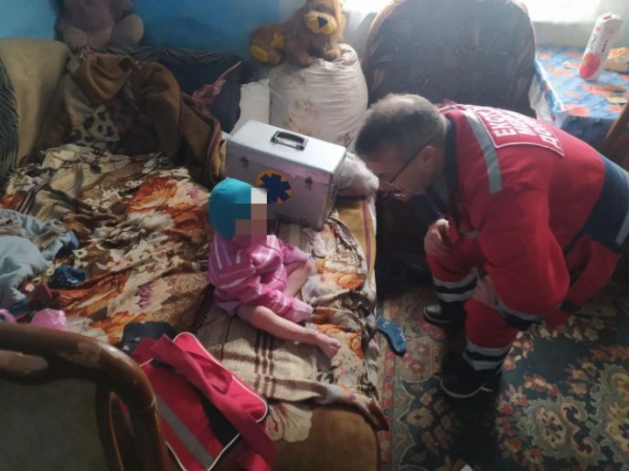 На Буковине у пьяной матери забрали ребенка с тяжелыми ожогами (ФОТО)