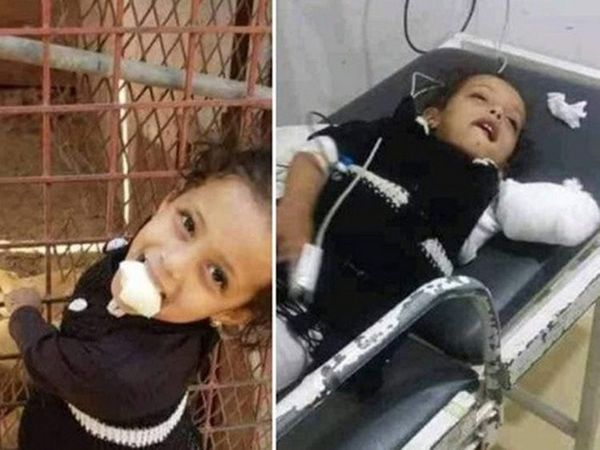 В зоопарке в Йемене лев откусил руку девочке: отец ребенка впал в кому (ФОТО)