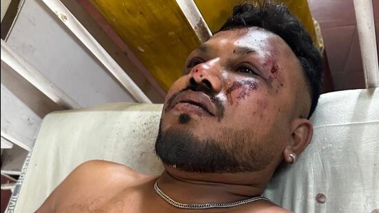 В крушении самолета, следовавшего из Индии в Лондон, выжил гражданин Британии