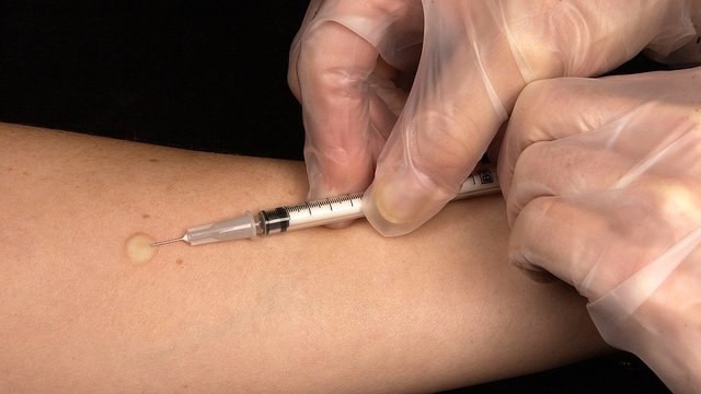 В апреле в Украине зарегистрировано 920 новых пациентов с туберкулезом