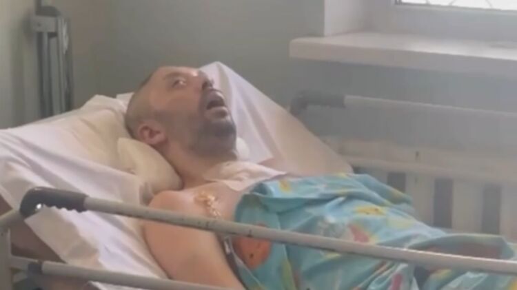 В Днепре мужчина впал в кому после избиения военкомами — омбудсмен Лубинец