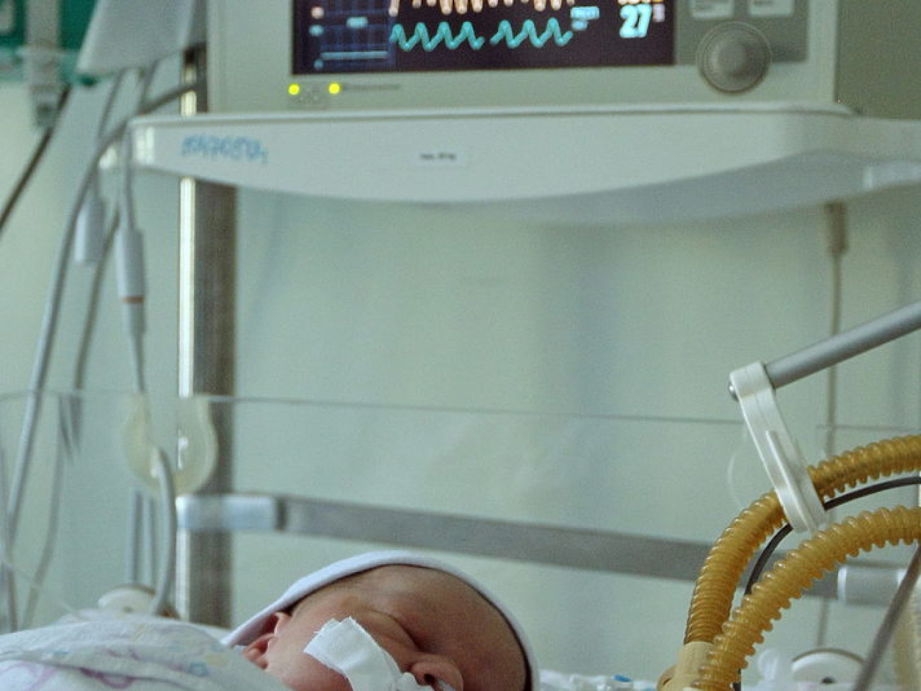 В Центре детской кардиологии и кардиохирургии появился уникальный аппарат искусственного дыхания