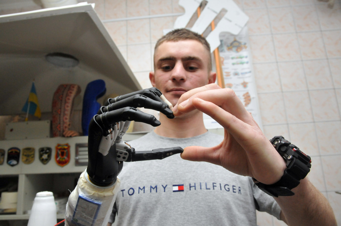 В Харькове военнослужащим, потерявшим конечности, изготавливают высокотехнологичные миоэлектрические протезы