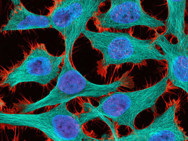 Японские ученые создали клетки, которые убивают раковые опухоли