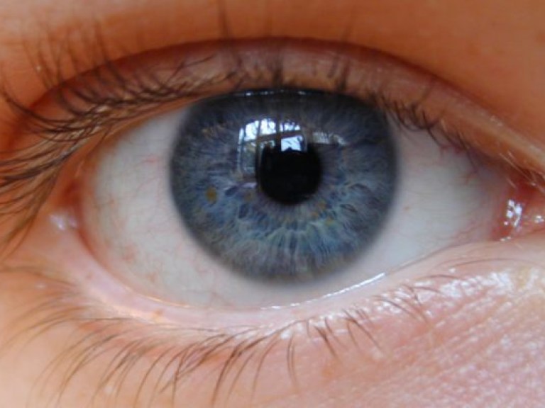 В «синдроме сухого глаза» виноват не только компьютер – врач