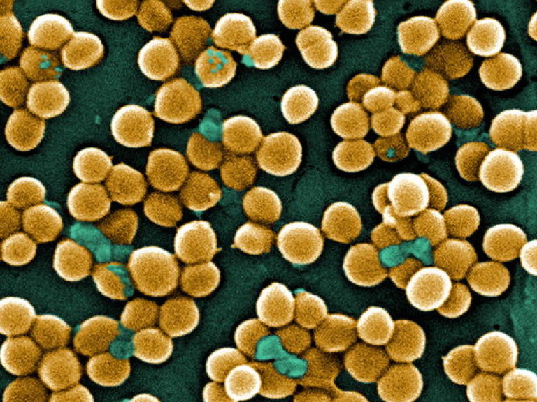 Бактерии золотистого стафилококка способны управлять нервной системой