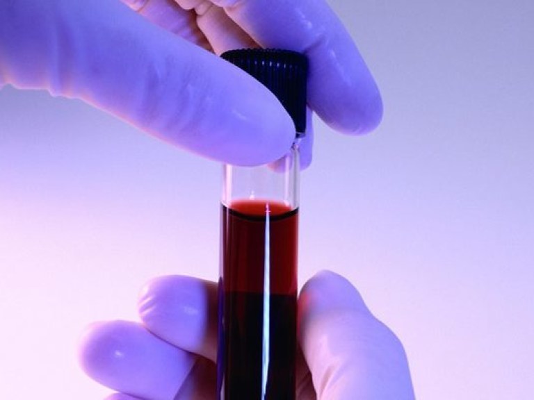 Румынские ученые изобрели искусственную кровь