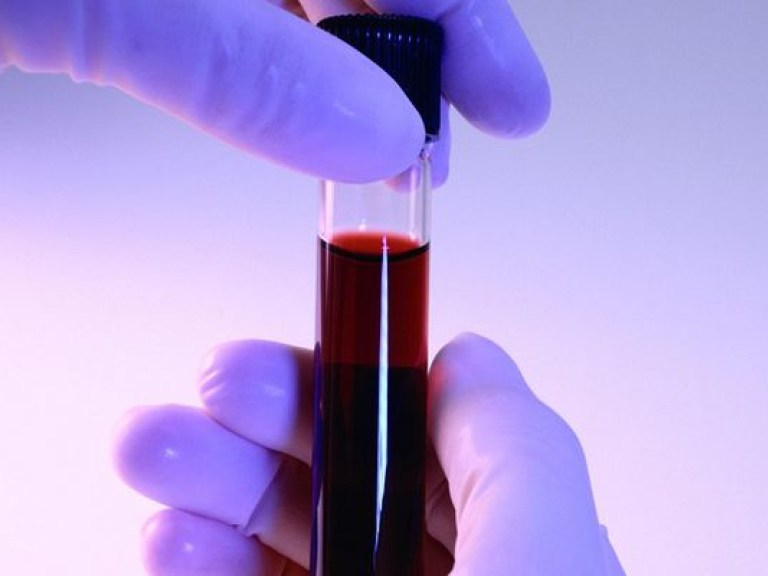 Сдавать анализ крови из пальца нужно раз в год — медики