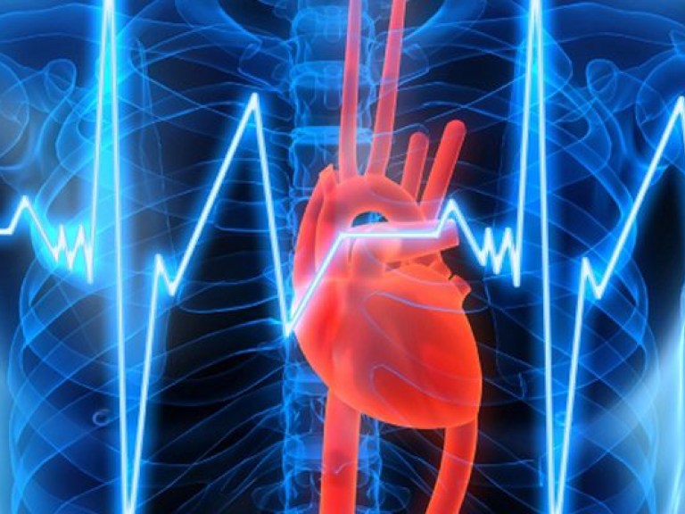 Во Франции впервые пересадили искусственное сердце