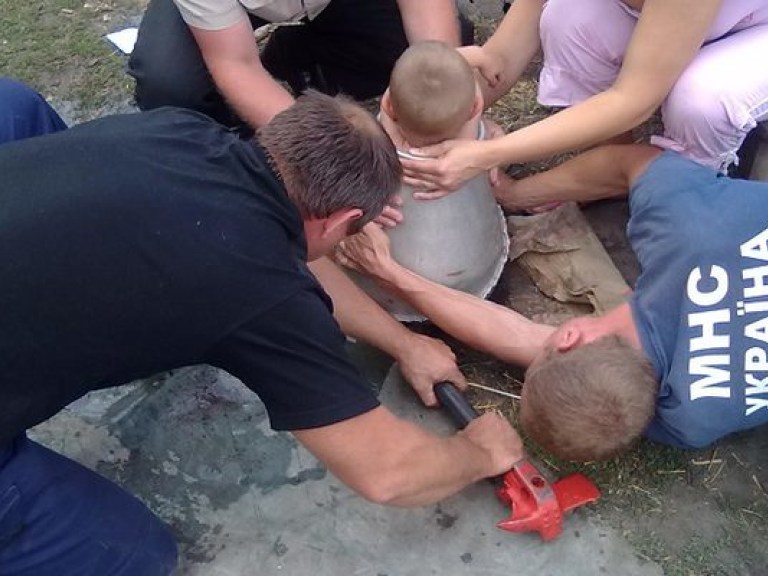 В Николаеве спасатели извлекли из бидона застрявшего в нем малыша