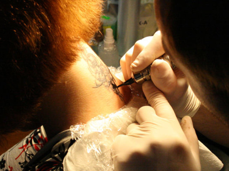 Ученые выяснили, что удаление татуировок увеличивает риск развития рака кожи