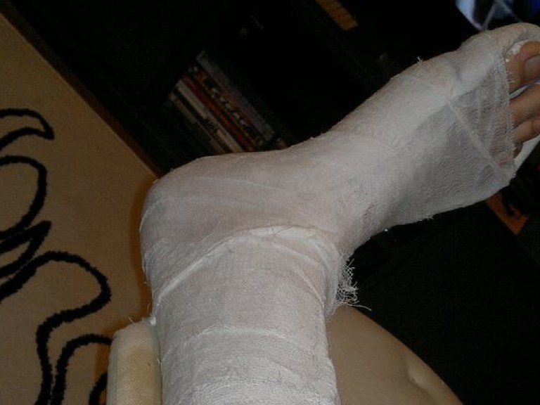 Киевлянин сломал ногу из-за разбитого тротуара (ФОТО)