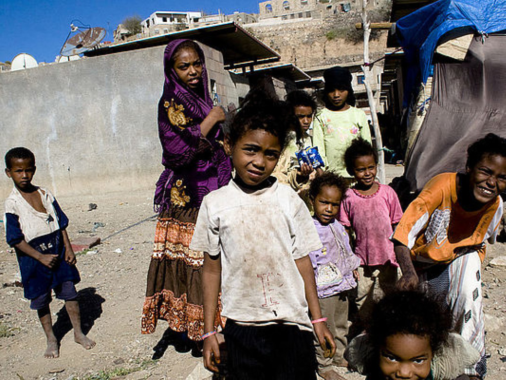 В Йемене от голода и болезней ежедневно умирают 130 детей