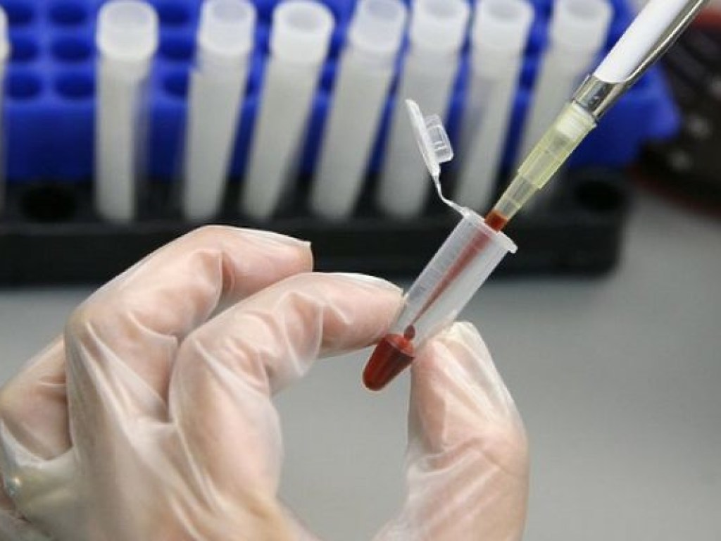 Гепатит А подтвердили у 15 взрослых жителей Николаевской области и одного ребенка – ОГА