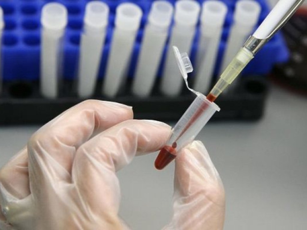 Вспышки гепатита А распространятся по другим регионам Украины – врач