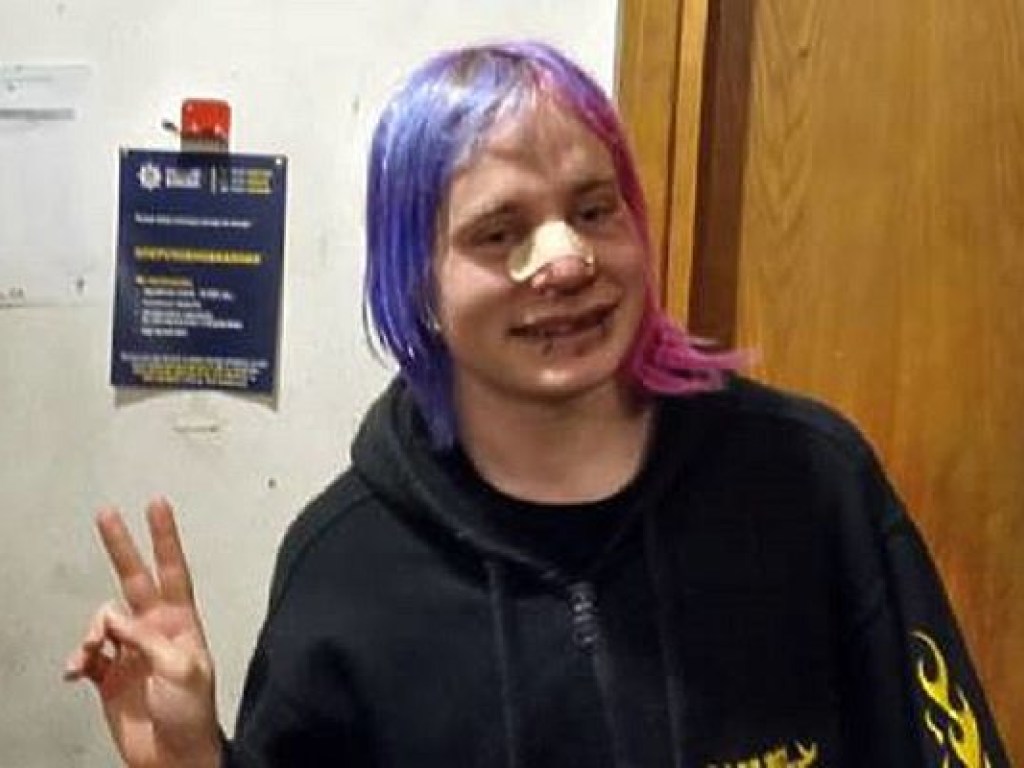 Иностранца с фиолетовыми волосами избили ногами в центре Киева (ФОТО)