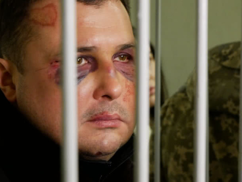 Военная прокуратура завела дело о похищении и избиении Шепелева