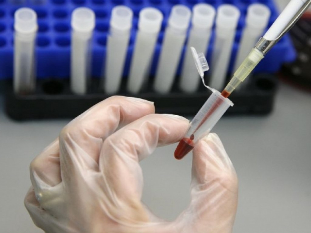 В Николаеве 29 человек госпитализированы с подозрением на гепатит А