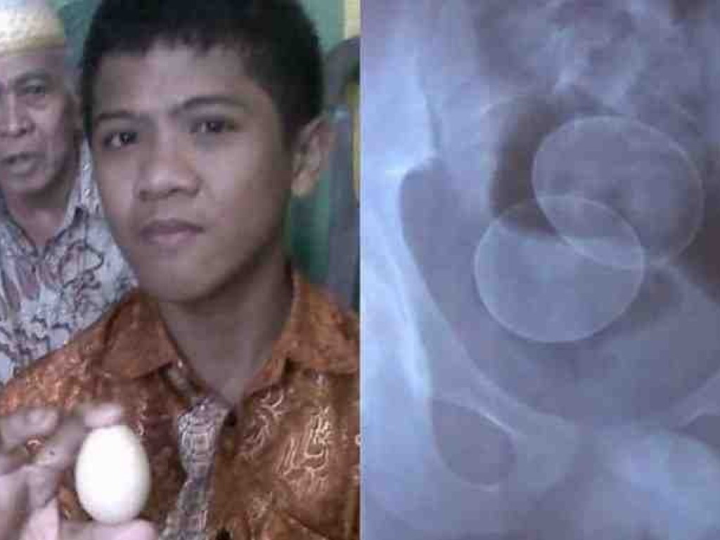Индонезийский мальчик заявил, что умеет нести куриные яйца (ФОТО)