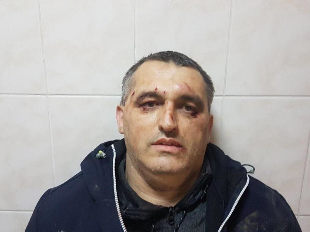 В Черновцах неизвестные избили арматурой представителя организации «Стоп коррупции»