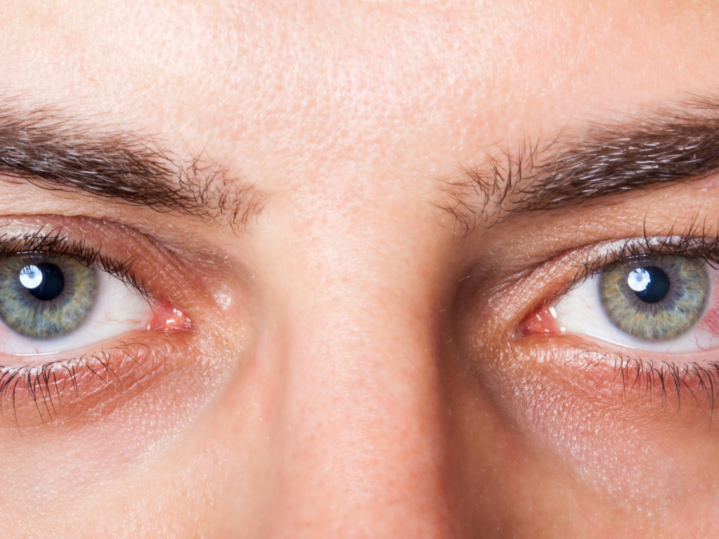Покраснения глаз у стариков могут свидетельствовать о проблемах с памятью – ученые