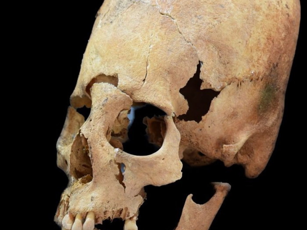 Археологи приблизились к разгадке тайны обнаруженных в Германии удлиненных черепов (ФОТО)