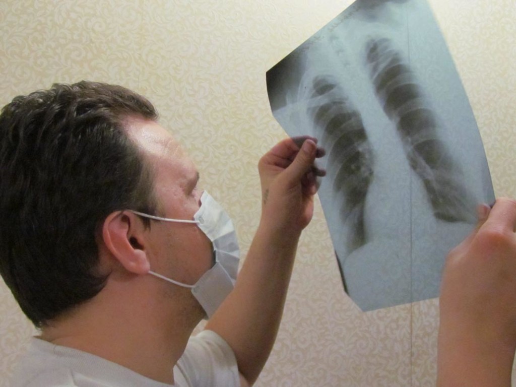 В Киеве грядет массовое сокращение коек для туберкулезных больных – профсоюз