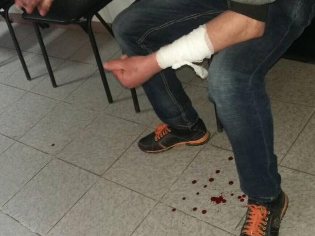 Криворожанин порезал себе вены в горотделе полиции (ФОТО)