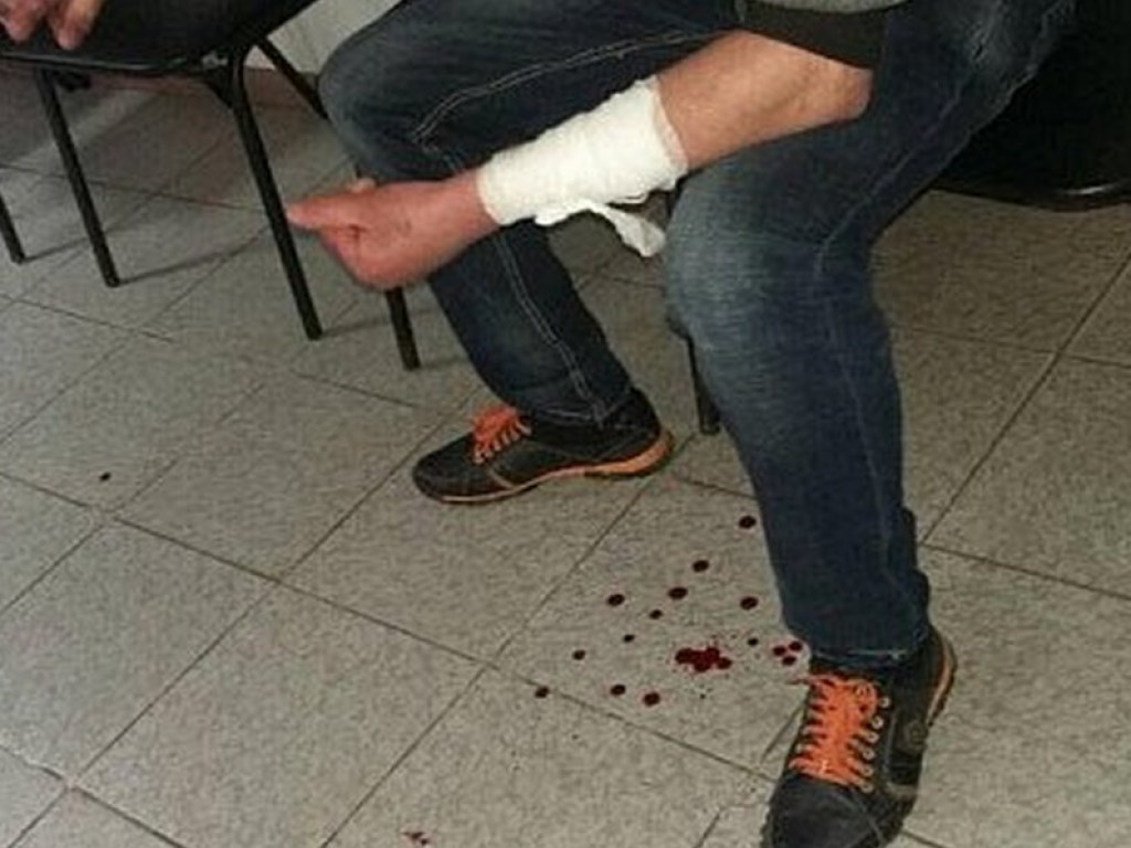 В полицейском участке Кривого Рога нетрезвый мужчина пытался покончить с собой (ФОТО)
