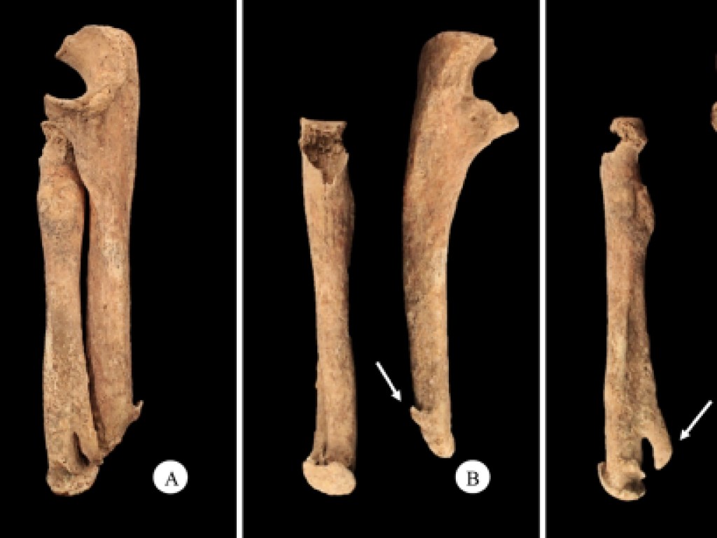 Останки мужчины-киборга археологи обнаружили в Италии (ФОТО)