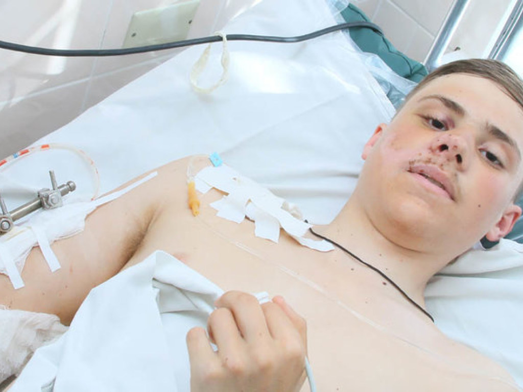 15-летний парень упал с девятого этажа, когда тащил туда украинский флаг (ФОТО)