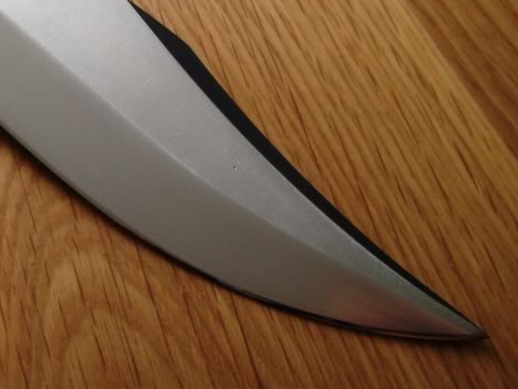 Девушка воткнула нож в лицо своей обидчице (ФОТО)