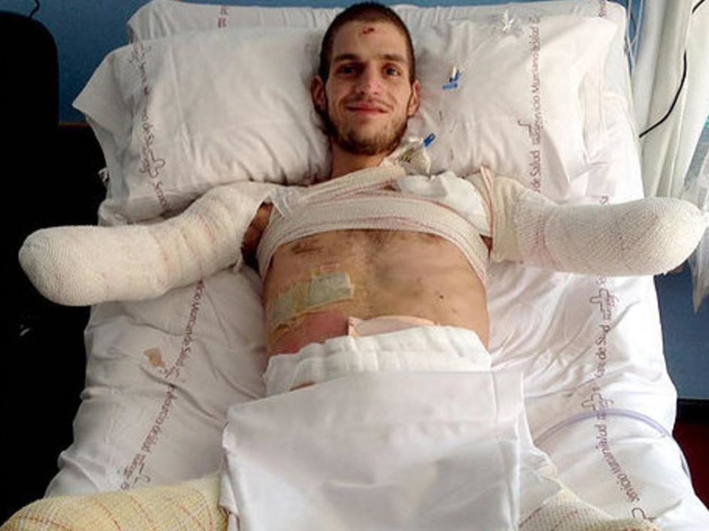 В Испании спортсмен потерял руки и ноги из-за «простуды» (ФОТО)