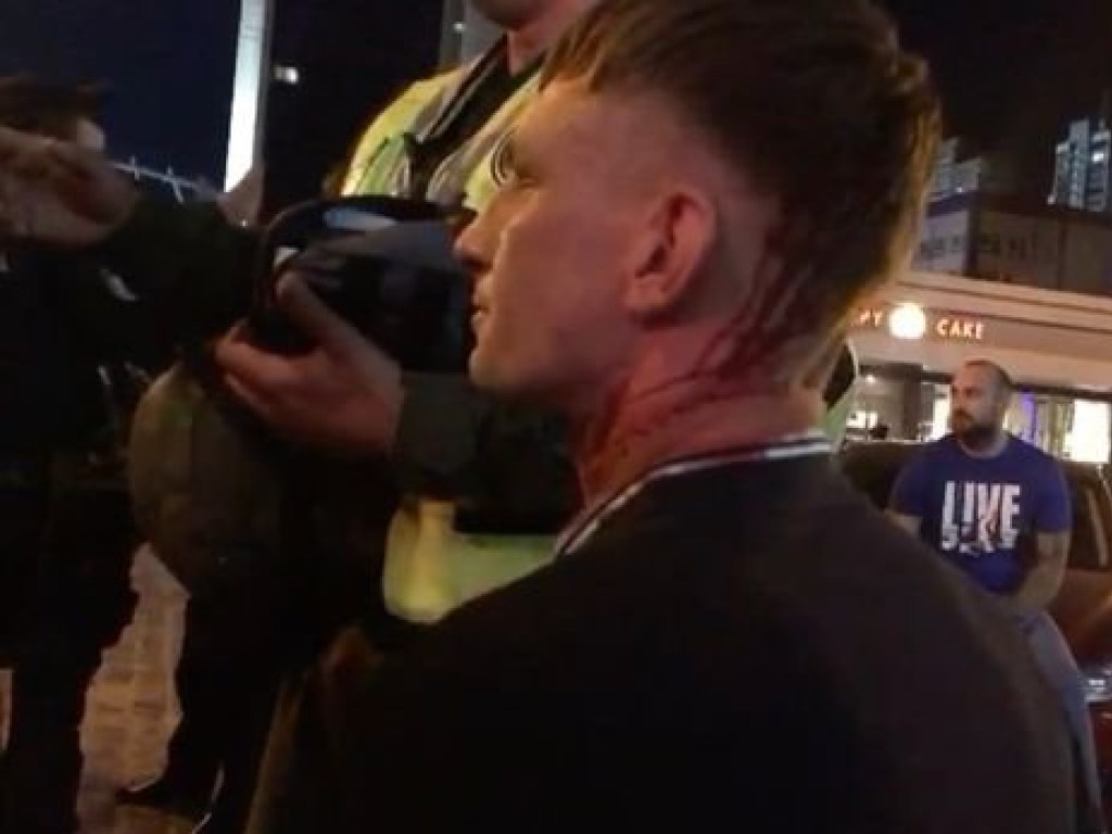 Драка в центре Киева: избитые фанаты «Ливерпуля» отказались писать заявления в полицию